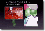 ꎟp